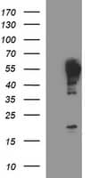 HEK293T cells were transfected with the pCMV6-ENTRY control (Left lane) or pCMV6-ENTRY TUBB2A (, Right lane) cDNA for 48 hrs and lysed. Equivalent amounts of cell lysates (5 ug per lane) were separated by SDS-PAGE and immunoblotted with anti-TUBB2A. 