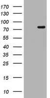 HEK293T cells were transfected with the pCMV6-ENTRY control ( Left lane) or pCMV6-ENTRY POLI ( Right lane) cDNA for 48 hrs and lysed. Equivalent amounts of cell lysates (5 ug per lane) were separated by SDS-PAGE and immunoblotted with anti-POLI. Positive lysates