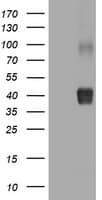 HEK293T cells were transfected with the pCMV6-ENTRY control (Left lane) or pCMV6-ENTRY NEU1 (, Right lane) cDNA for 48 hrs and lysed. Equivalent amounts of cell lysates (5 ug per lane) were separated by SDS-PAGE and immunoblotted with anti-NEU1. 