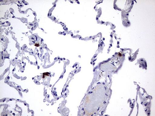 Immunohistochemical staining of paraffin-embedded Human lung tissue using anti-USP48 mouse monoclonal antibody. . Heat-induced epitope retrieval by EDTA solution buffer pH 8.0 at 120Â°C for 3 min.