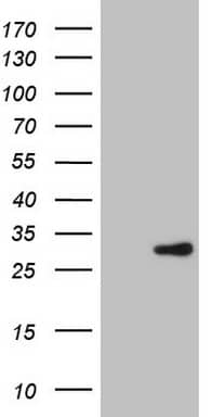Human recombinant protein fragment corresponding to amino acids 78-307 of human E_000391) produced in E.coli.