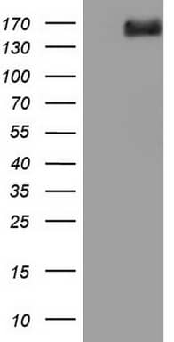 HEK293T cells were transfected with the pCMV6-ENTRY control ( Left lane) or pCMV6-ENTRY DCC ( Right lane) cDNA for 48 hrs and lysed. Equivalent amounts of cell lysates (5 ug per lane) were separated by SDS-PAGE and immunoblotted with anti-DCC. Positive lysates