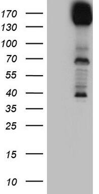 HEK293T cells were transfected with the pCMV6-ENTRY control (Left lane) or pCMV6-ENTRY DCC (, Right lane) cDNA for 48 hrs and lysed. Equivalent amounts of cell lysates (5 ug per lane) were separated by SDS-PAGE and immunoblotted with anti-DCC. 