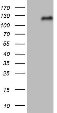 HEK293T cells were transfected with the pCMV6-ENTRY control ( Left lane) or pCMV6-ENTRY NFE2L2 ( Right lane) cDNA for 48 hrs and lysed. Equivalent amounts of cell lysates (5 ug per lane) were separated by SDS-PAGE and immunoblotted with anti-NFE2L2.
