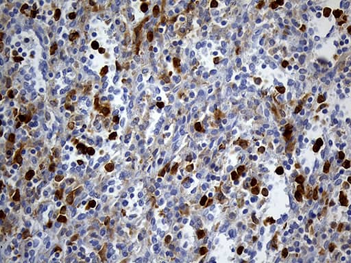 Immunohistochemical staining of paraffin-embedded Human spleen tissue within the normal limits using anti-UBE3B mouse monoclonal antibody. Heat-induced epitope retrieval by EDTA solution buffer pH 8.0 at 120Â°C for 3 min.
