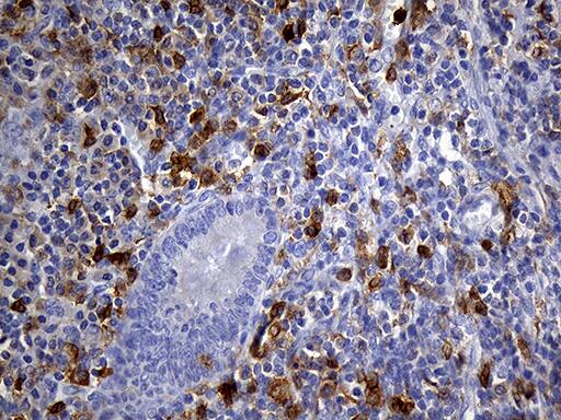 Immunohistochemical staining of paraffin-embedded Human appendix tissue within the normal limits using anti-UBE3B mouse monoclonal antibody. Heat-induced epitope retrieval by EDTA solution buffer pH 8.0 at 120Â°C for 3 min.