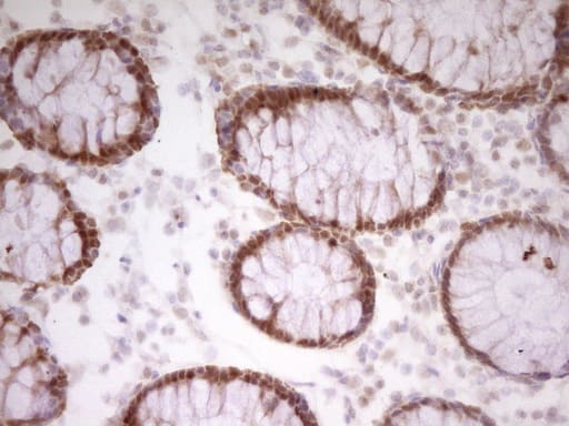 Immunohistochemical staining of paraffin-embedded Human colon tissue within the normal limits using anti-PAPSS2 mouse monoclonal antibody. Heat-induced epitope retrieval by EDTA solution buffer pH 8.0 at 120Â°C for 3 min.