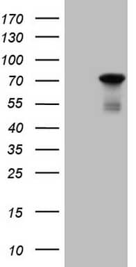 HEK293T cells were transfected with the pCMV6-ENTRY control (Left lane) or pCMV6-ENTRY PAPSS2 (, Right lane) cDNA for 48 hrs and lysed. Equivalent amounts of cell lysates (5 ug per lane) were separated by SDS-PAGE and immunoblotted with anti-PAPSS2. 