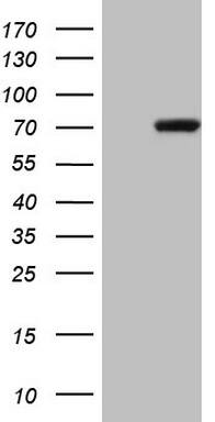 HEK293T cells were transfected with the pCMV6-ENTRY control (Left lane) or pCMV6-ENTRY PAPSS2 (, Right lane) cDNA for 48 hrs and lysed. Equivalent amounts of cell lysates (5 ug per lane) were separated by SDS-PAGE and immunoblotted with anti-PAPSS2. 