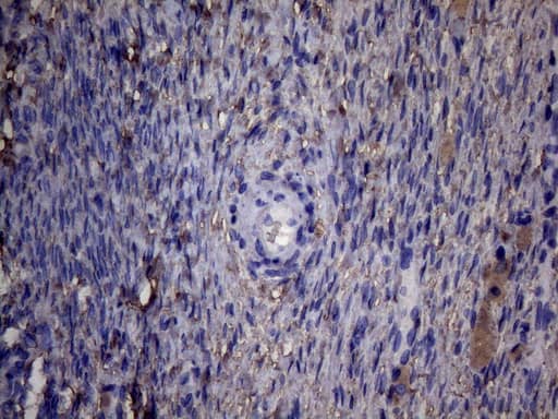 Immunohistochemical staining of paraffin-embedded Human Ovary tissue within the normal limits using anti-PAPSS2 mouse monoclonal antibody. Heat-induced epitope retrieval by EDTA solution buffer pH 8.0 at 120Â°C for 3 min.