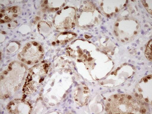 Immunohistochemical staining of paraffin-embedded Human Kidney tissue within the normal limits using anti-PAPSS2 mouse monoclonal antibody. Heat-induced epitope retrieval by EDTA solution buffer pH 8.0 at 120Â°C for 3 min.