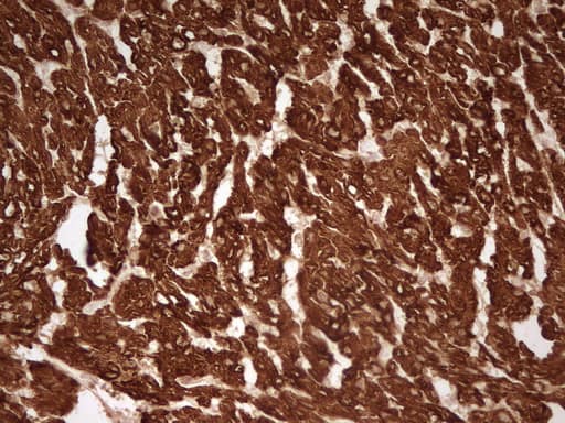 Immunohistochemical staining of paraffin-embedded Human adult heart tissue using anti-TNNT2 mouse monoclonal antibody. Heat-induced epitope retrieval by EDTA solution buffer pH 8.0 at 120Â°C for 3 min.