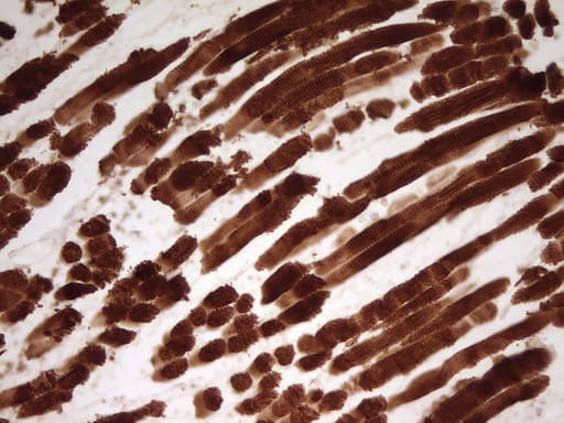Immunohistochemical staining of paraffin-embedded Human musue using anti-TNNT2 mouse monoclonal antibody. Heat-induced epitope retrieval by EDTA solution buffer pH 8.0 at 120Â°C for 3 min.