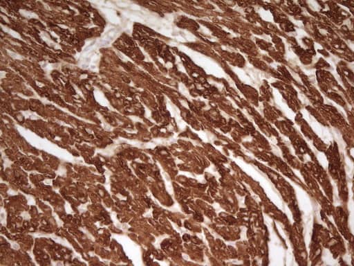Immunohistochemical staining of paraffin-embedded Human adult heart tissue using anti-TNNT2 mouse monoclonal antibody. Heat-induced epitope retrieval by EDTA solution buffer pH 8.0 at 120Â°C for 3 min.