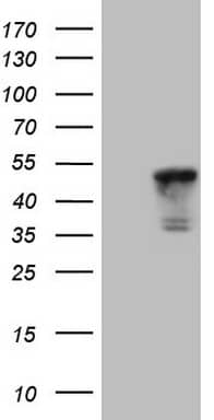 HEK293T cells were transfected with the pCMV6-ENTRY control (Left lane) or pCMV6-ENTRY TNNT2 (, Right lane) cDNA for 48 hrs and lysed. Equivalent amounts of cell lysates (5 ug per lane) were separated by SDS-PAGE and immunoblotted with anti-TNNT2. 