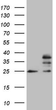 HEK293T cells were transfected with the pCMV6-ENTRY control (Left lane) or pCMV6-ENTRY MRPS15 (, Right lane) cDNA for 48 hrs and lysed. Equivalent amounts of cell lysates (5 ug per lane) were separated by SDS-PAGE and immunoblotted with anti-MRPS15 (1:2000). 