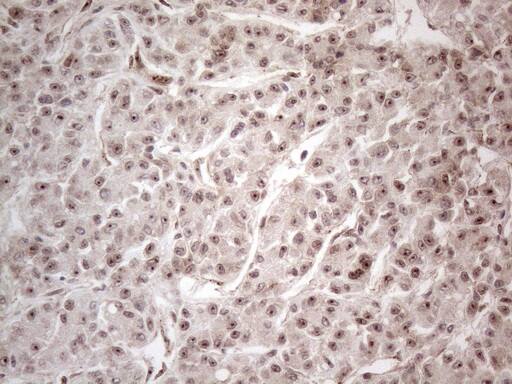 Immunohistochemistry HMGB4 Antibody (OTI5G3)