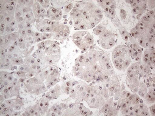 Immunohistochemistry HMGB4 Antibody (OTI5G3)