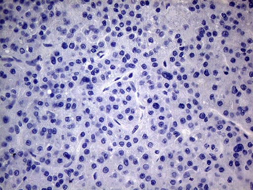 Immunohistochemistry PMP22 Antibody (OTI5D1)