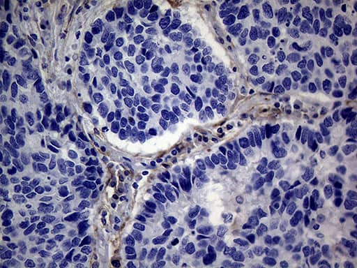 Immunohistochemistry PMP22 Antibody (OTI5D1)