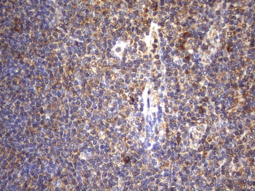 Immunohistochemical staining of paraffin-embedded Human tonsil within the normal limits using anti-CYTH2 mouse monoclonal antibody. Heat-induced epitope retrieval by EDTA solution buffer pH 8.0 at 120Â°C for 3 min.