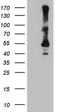 HEK293T cells were transfected with the pCMV6-ENTRY control ( Left lane) or pCMV6-ENTRY CYTH2 ( Right lane) cDNA for 48 hrs and lysed. Equivalent amounts of cell lysates (5 ug per lane) were separated by SDS-PAGE and immunoblotted with anti-CYTH2 (1:2000). Positive lysates