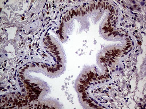 Immunohistochemical staining of paraffin-embedded Human lung tissue within the normal limits using anti-MAGEB4 mouse monoclonal antibody. Heat-induced epitope retrieval by EDTA solution buffer pH 8.0 at 120Â°C for 3 min.