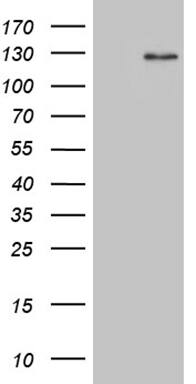 HEK293T cells were transfected with the pCMV6-ENTRY control ( Left lane) or pCMV6-ENTRY DACT1 ( Right lane) cDNA for 48 hrs and lysed. Equivalent amounts of cell lysates (5 ug per lane) were separated by SDS-PAGE and immunoblotted with anti-DACT1 (1:2000).