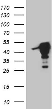 HEK293T cells were transfected with the pCMV6-ENTRY control (Left lane) or pCMV6-ENTRY MAGEB4 (, Right lane) cDNA for 48 hrs and lysed. Equivalent amounts of cell lysates (5 ug per lane) were separated by SDS-PAGE and immunoblotted with anti-MAGEB4 (1:2000). 