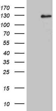 HEK293T cells were transfected with the pCMV6-ENTRY control (Left lane) or pCMV6-ENTRY DACT1 (, Right lane) cDNA for 48 hrs and lysed. Equivalent amounts of cell lysates (5 ug per lane) were separated by SDS-PAGE and immunoblotted with anti-DACT1 (1:2000).