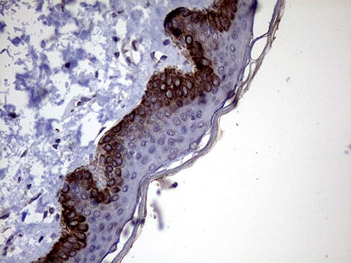 Immunohistochemical staining of paraffin-embedded Human skin tissue within the normal limits using anti-P4HA3 mouse monoclonal antibody. Heat-induced epitope retrieval by EDTA solution buffer pH 8.0 at 120Â°C for 3 min.