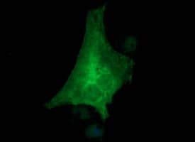 Immunofluorescence:Tyrosine Hydroxylase Antibody (OTI1A12)[NBP3-44720]