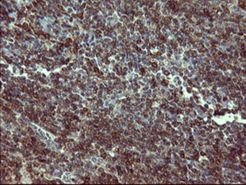 Immunohistochemistry:Tyrosine Hydroxylase Antibody (OTI1A12)[NBP3-44720]