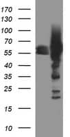 Western Blot:Tyrosine Hydroxylase Antibody (OTI1A12)[NBP3-44720]