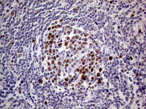 Immunohistochemical staining of paraffin-embedded Human lymph node tissue within the normal limits using anti-MAGEB4 mouse monoclonal antibody. Heat-induced epitope retrieval by EDTA solution buffer pH 8.0 at 120Â°C for 3 min.