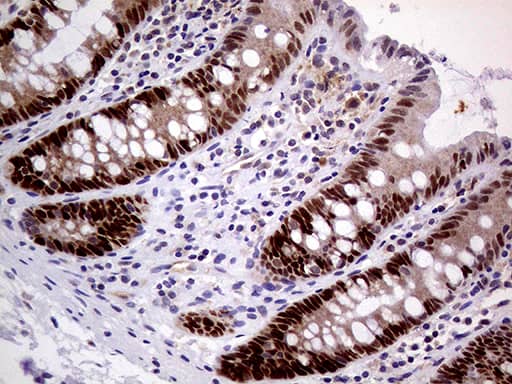 Immunohistochemical staining of paraffin-embedded Human colon tissue within the normal limits using anti-MAGEB4 mouse monoclonal antibody. Heat-induced epitope retrieval by EDTA solution buffer pH 8.0 at 120Â°C for 3 min.