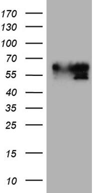HEK293T cells were transfected with the pCMV6-ENTRY control (Left lane) or pCMV6-ENTRY BNIPL (, Right lane) cDNA for 48 hrs and lysed. Equivalent amounts of cell lysates (5 ug per lane) were separated by SDS-PAGE and immunoblotted with anti-BNIPL (1:2000). 