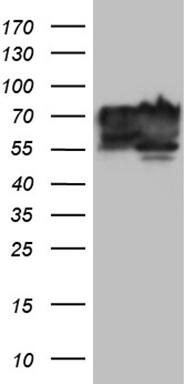 HEK293T cells were transfected with the pCMV6-ENTRY control (Left lane) or pCMV6-ENTRY BNIPL (, Right lane) cDNA for 48 hrs and lysed. Equivalent amounts of cell lysates (5 ug per lane) were separated by SDS-PAGE and immunoblotted with anti-BNIPL (1:2000). 