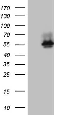 HEK293T cells were transfected with the pCMV6-ENTRY control ( Left lane) or pCMV6-ENTRY BNIPL ( Right lane) cDNA for 48 hrs and lysed. Equivalent amounts of cell lysates (5 ug per lane) were separated by SDS-PAGE and immunoblotted with anti-BNIPL (1:2000). Positive lysates