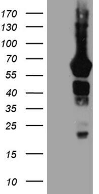 HEK293T cells were transfected with the pCMV6-ENTRY control ( Left lane) or pCMV6-ENTRY GRB7 ( Right lane) cDNA for 48 hrs and lysed. Equivalent amounts of cell lysates (5 ug per lane) were separated by SDS-PAGE and immunoblotted with anti-GRB7(1:2000). Positive lysates
