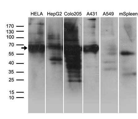 Western blot analysis of extracts (35ug) from 5 different cell lines and mouse spleen tissue lysate by using anti-GRB7 monoclonal antibody (1:500).