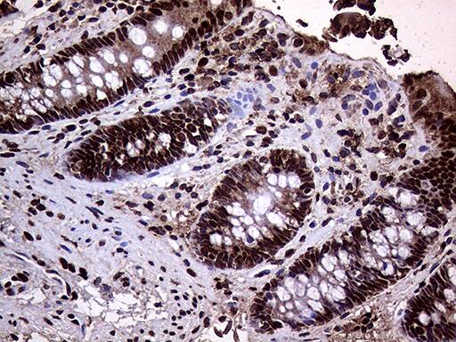 Immunohistochemistry TRMT5 Antibody (OTI1B5)