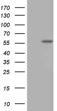 HEK293T cells were transfected with the pCMV6-ENTRY control (Left lane) or pCMV6-ENTRY TBX20 (, Right lane) cDNA for 48 hrs and lysed. Equivalent amounts of cell lysates (5 ug per lane) were separated by SDS-PAGE and immunoblotted with anti-TBX20 (1:2000). 