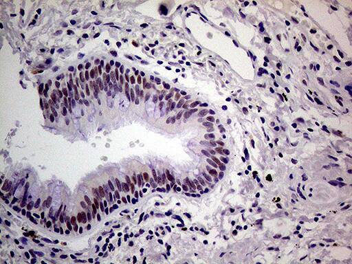 Immunohistochemical staining of paraffin-embedded Human lung tissue within the normal limits using anti-THOC3 mouse monoclonal antibody. Heat-induced epitope retrieval by EDTA solution buffer pH 8.0 at 120Â°C for 3 min.