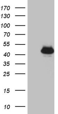 HEK293T cells were transfected with the pCMV6-ENTRY control ( Left lane) or pCMV6-ENTRY THOC3 ( Right lane) cDNA for 48 hrs and lysed. Equivalent amounts of cell lysates (5 ug per lane) were separated by SDS-PAGE and immunoblotted with anti-THOC3 (1:2000). Positive lysates
