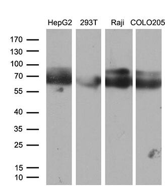 Western blot analysis of extracts (35ug) from 4 different cell lines by using anti-CACNB1 monoclonal antibody (1:500).