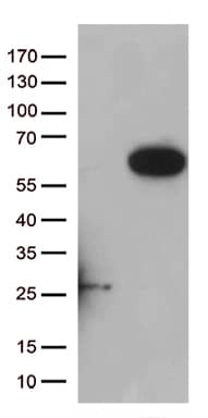 HEK293T cells were transfected with the pCMV6-ENTRY control ( Left lane) or pCMV6-ENTRY RASSF9 ( Right lane) cDNA for 48 hrs and lysed. Equivalent amounts of cell lysates (5 ug per lane) were separated by SDS-PAGE and immunoblotted with anti-RASSF9(1:500). Positive lysates