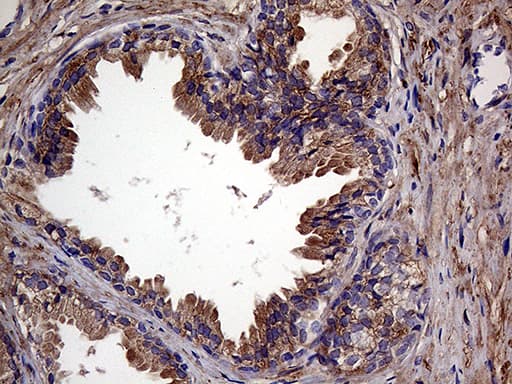 Immunohistochemical staining of paraffin-embedded Human prostate tissue within the normal limits using anti-RAB23 mouse monoclonal antibody. Heat-induced epitope retrieval by EDTA solution buffer pH 8.0 at 120Â°C for 3 min.