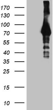 HEK293T cells were transfected with the pCMV6-ENTRY control (Left lane) or pCMV6-ENTRY HABP2 (, Right lane) cDNA for 48 hrs and lysed. Equivalent amounts of cell lysates (5 ug per lane) were separated by SDS-PAGE and immunoblotted with anti-HABP2 (1:2000). 