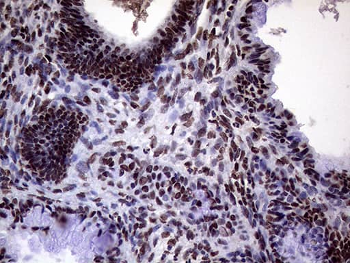 Immunohistochemistry XRN2 Antibody (OTI5F4)